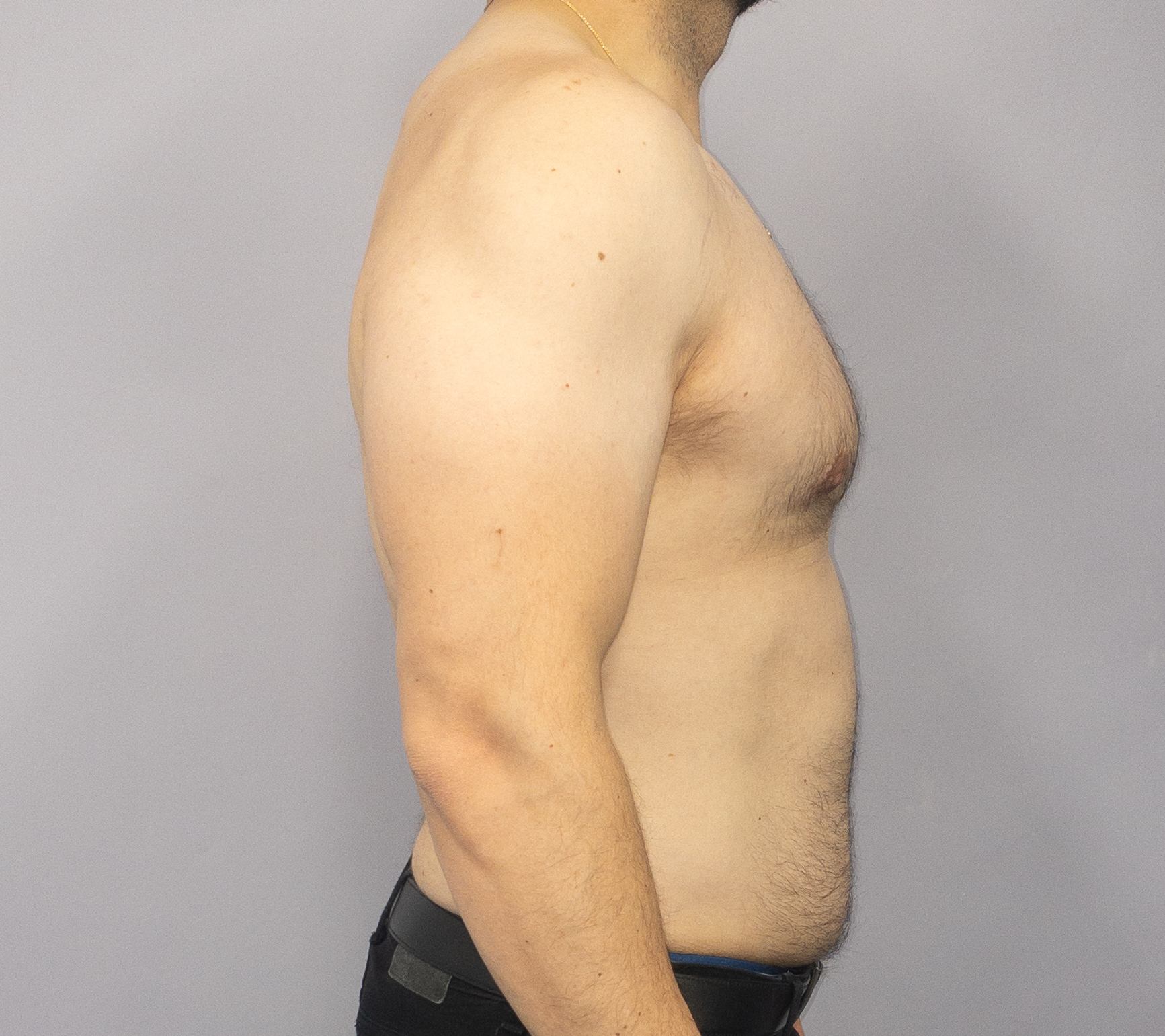 After Image